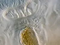 Microscopic image of a Rotifer Floscularia ringens feeding