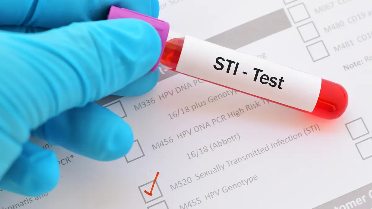 Are home STI tests safe and reliable? - Reviewed