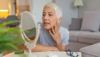 What is rosacea and what can you do for it?