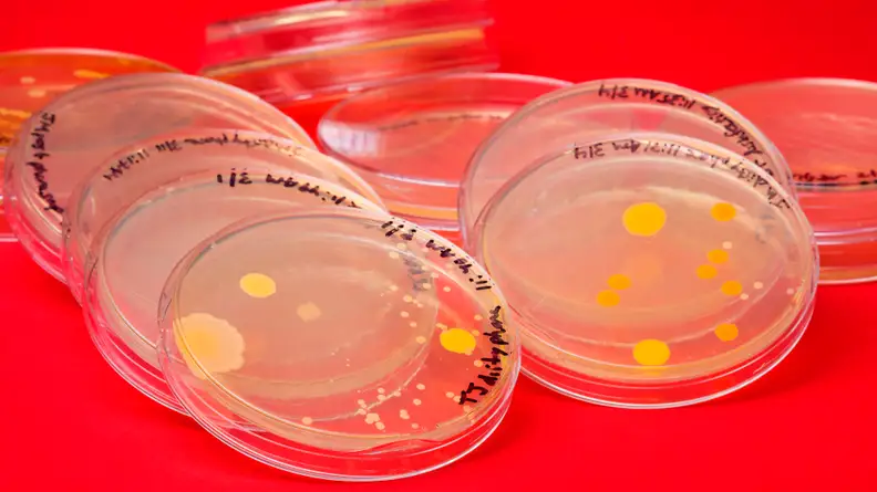 We tested these phone cleaners by growing bacteria from phones on agar plates before and after cleaning with a phone sanitizer.