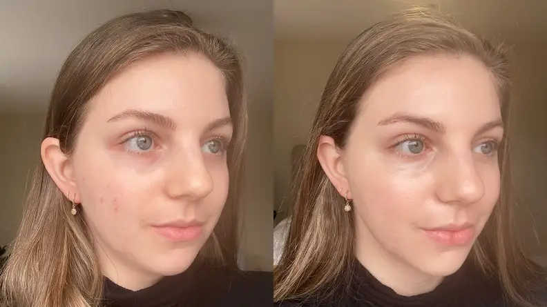 The author before and after applying foundation with a more even skin tone on the right.