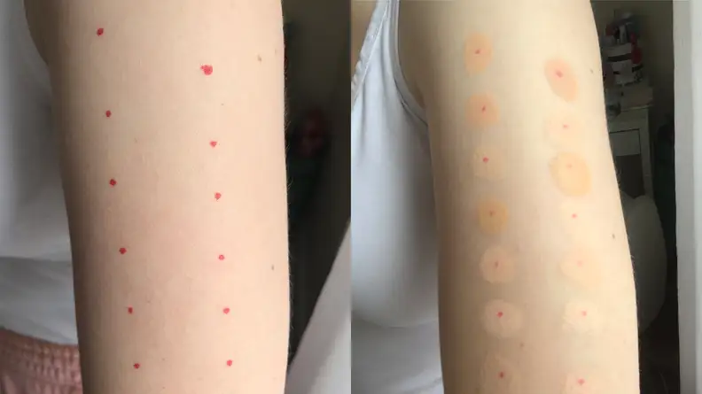 The author with swatches of concealers on her arm.