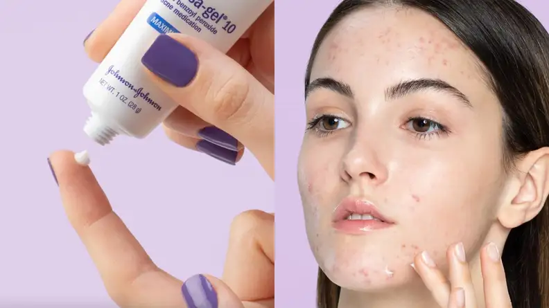 On the left: A finger stretched out with a squeeze tube held over it. On the right: A person's face as they apply a gel to the skin.