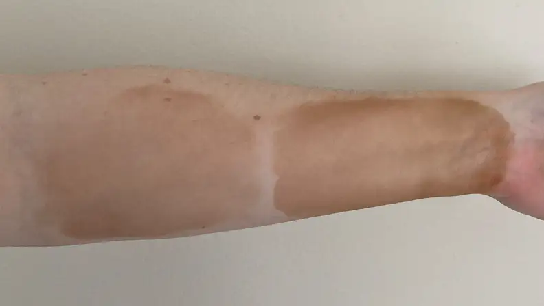 Person displaying tanning serum swatches on arm.
