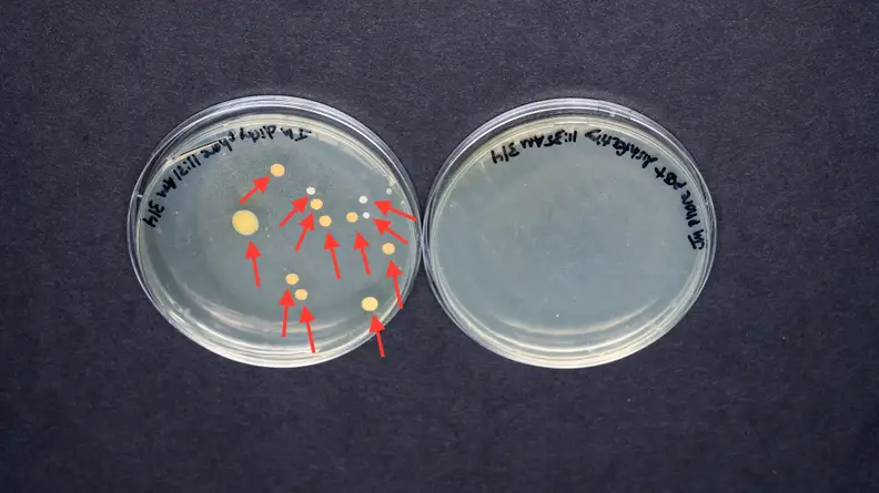 The bacteria on the first phone prior to cleaning with the DIY disinfecting solution are in the agar plate on the left, and the bacteria on the phone after cleaning with the DIY disinfecting solution are in the agar plate on the right.