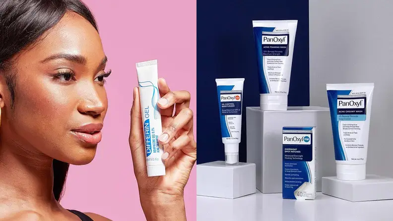 A model holds an acne treatment.
