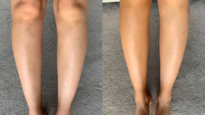 Before using the M-61 Hydraboost Gradual Tan Body Butter and two days after using it.