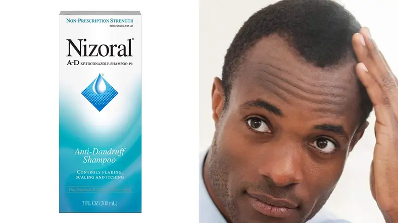A photo of the Nizoral A-D Anti-Dandruff Shampoo.