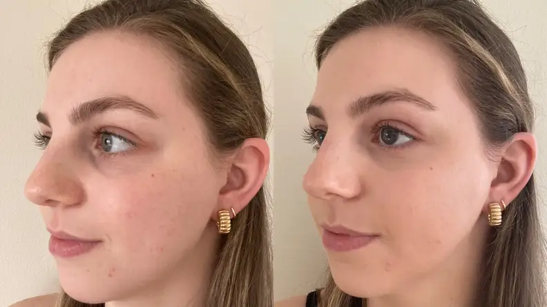 A closeup of the left side of the author's face before (left) and after (right) applying the Wet n Wild Bare Focus Tinted Hydrator.
