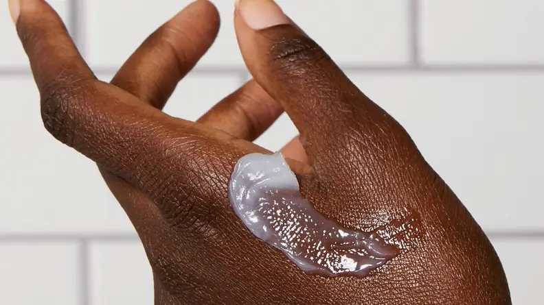 A closeup on a person's hand with ointment on it.