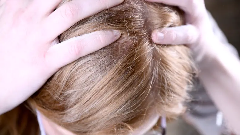 I put baking soda in my unwashed hair to see if it could make my hair feel clean.