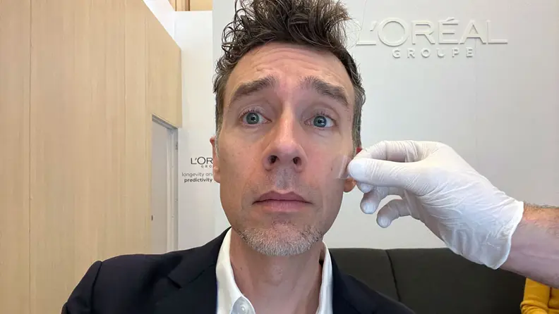 The author getting tested for L'Oreal Cell BioPrint