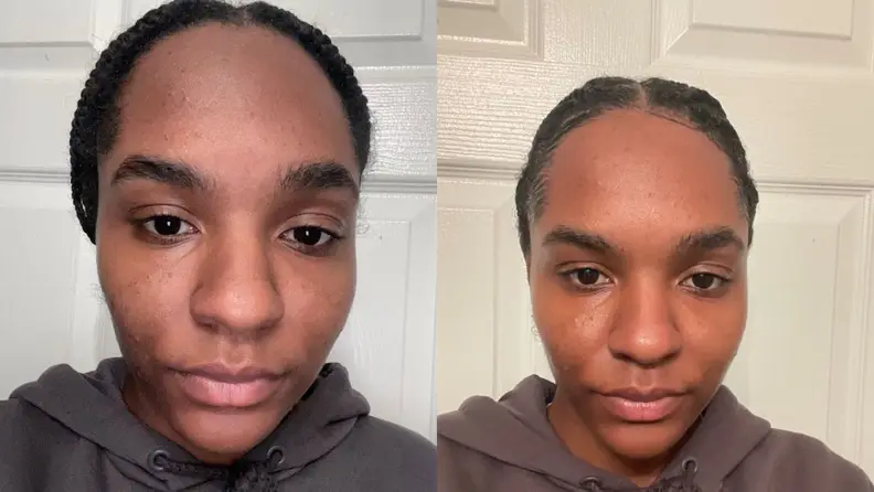 Left image is my skin prior to washing it with Loved01's products and the right image is my fave after washing it with Loved01's products