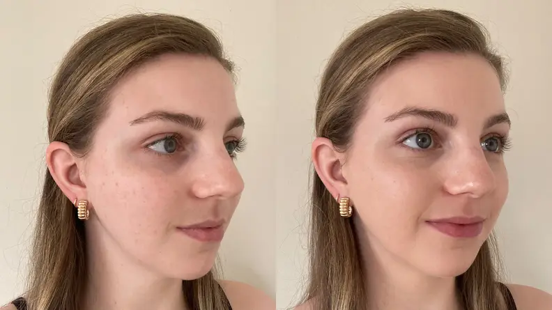 The right side of the author's face before (left) and after (right) applying the Wet n Wild Bare Focus Tinted Hydrator.