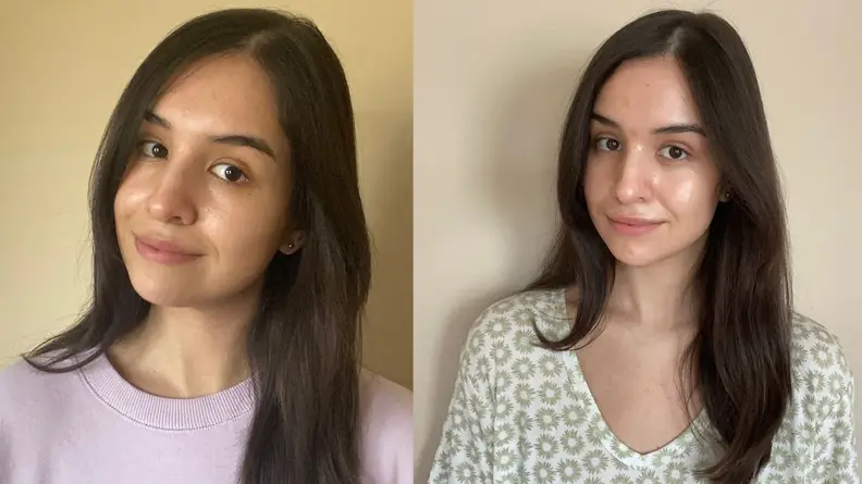 Person displaying before and after photo of glowy, clear skin.