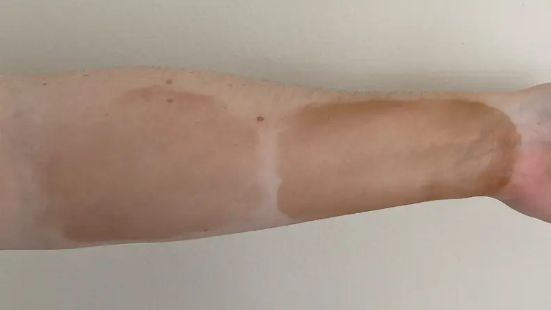 Person displaying tanning serum swatches on arm.