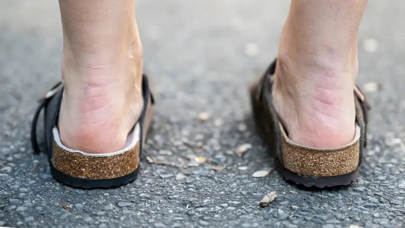 Photo of a person wearing Birkenstock Boston Clogs, seen from the back.