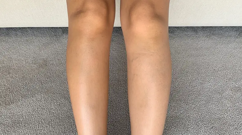 After day one of using the M-61 Hydraboost Gradual Tan Body Butter.