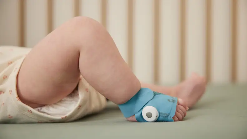 A pudgy baby leg with an Owlet BabySat monitor attached to the foot.