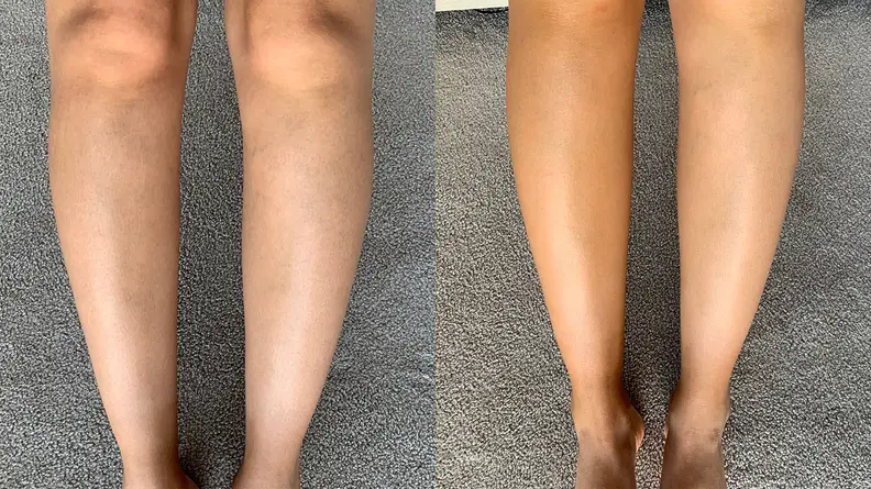 Before using the M-61 Hydraboost Gradual Tan Body Butter and two days after using it.