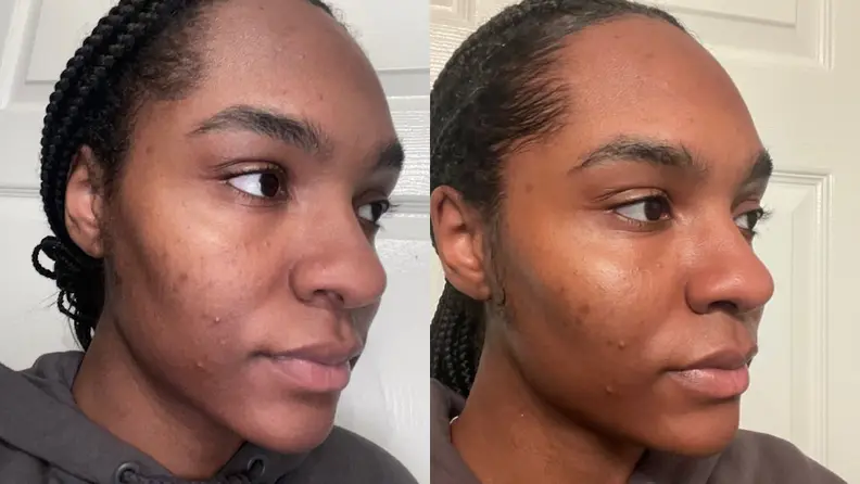 Left image is the side profile of my skin before using Loved01 and the right image is the side profile of my skin after using Loved01