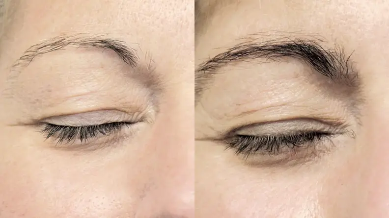 A woman before and after using the NeuBrow Brow Enhancing Serum.