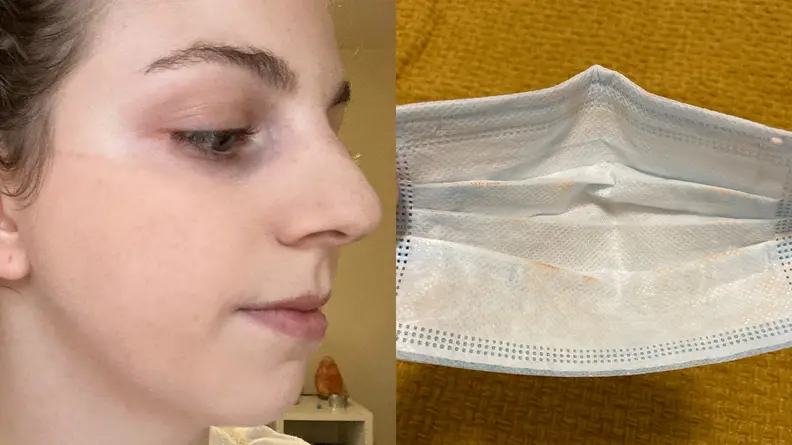 The author after wearing the Covergirl TruBlend Matte Made Liquid Foundation under a mask for an hour-long walk.