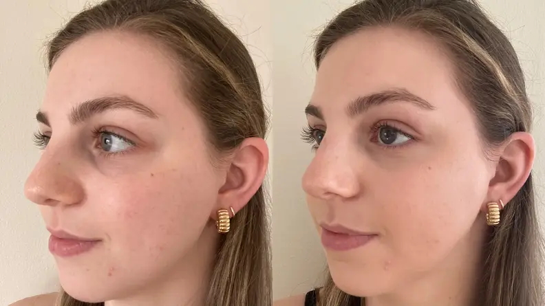 A closeup of the left side of the author's face before (left) and after (right) applying the Wet n Wild Bare Focus Tinted Hydrator.