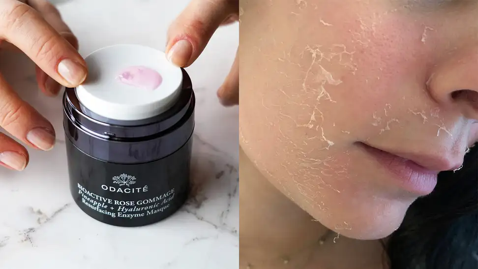 On the left: A black jar with a white lid and a pink liquid coming through a whole in the white lid. On the right: The author's cheek shows her skin peeling.